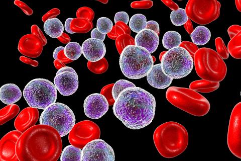 02malignant-lymphoma_0